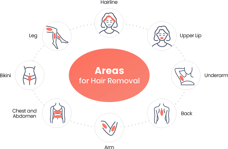 Areas for Hair Removal Areas for Hair Removal