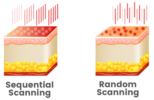 Smart scanning modality