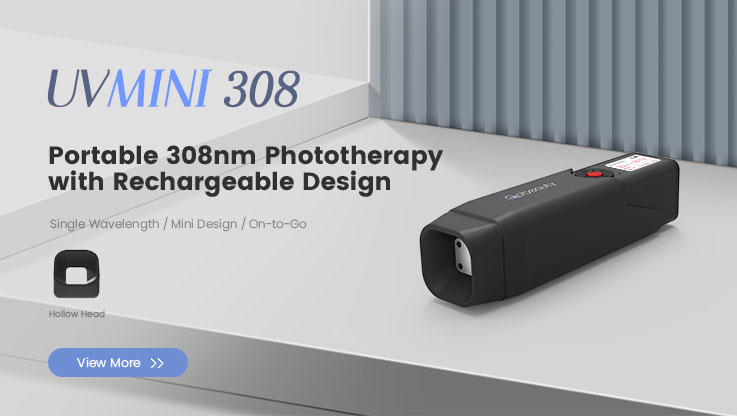 UVMini 308® Portable 308nm Excimer Light UVB Phototherapy with Rechargeable Design